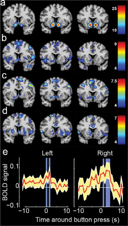 Composite fMRI brain-activation figure from Ferguson et al. (2016): panel (a) shows the standard reward network reference map; panel (e) shows time-locked nucleus accumbens activity peaking 1-3 seconds before subjects reported peak 'feeling the Spirit' moments during audiovisual stimuli.